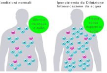 Intossicazione idrica