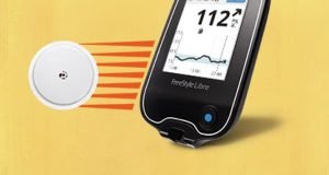 Dispositivo per il monitoraggio flash del diabete, disponibile gratis anche in Sicilia.
