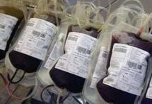 Caltanissetta, donna morta a causa di una trasfusione di sangue infetto: condannato il Ministero a un risarcimento di 800 mila euro sangue