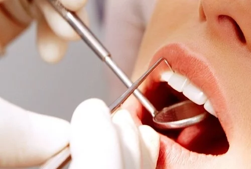 Contrattualizzazioni odontodriatiche, Cga