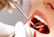 Contrattualizzazioni odontodriatiche, Cga