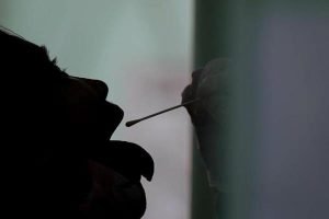 Agrigento, test sierologici per Covid-19: ecco come e dove farli in provincia